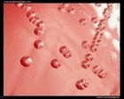 Listeria monocytogenes on blood agar